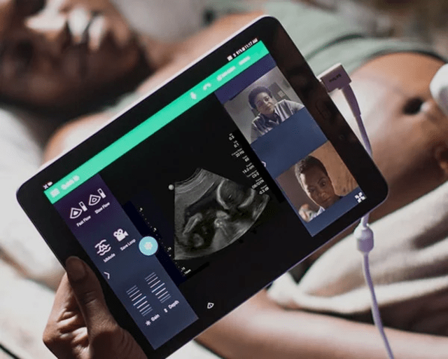 Philips Portfolio Image