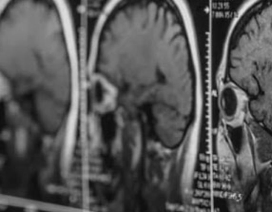AI Tissue Feature Detection System Portfolio Image